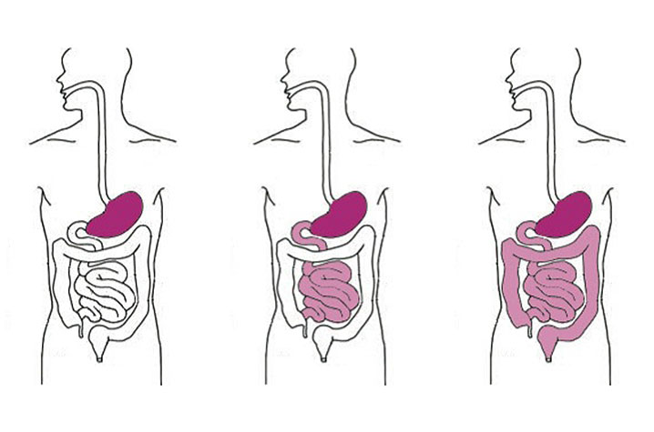 fermentation